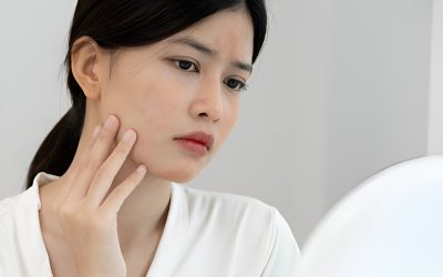 Bruntusan di Wajah? Bisa Jadi Ini Penyebabnya!